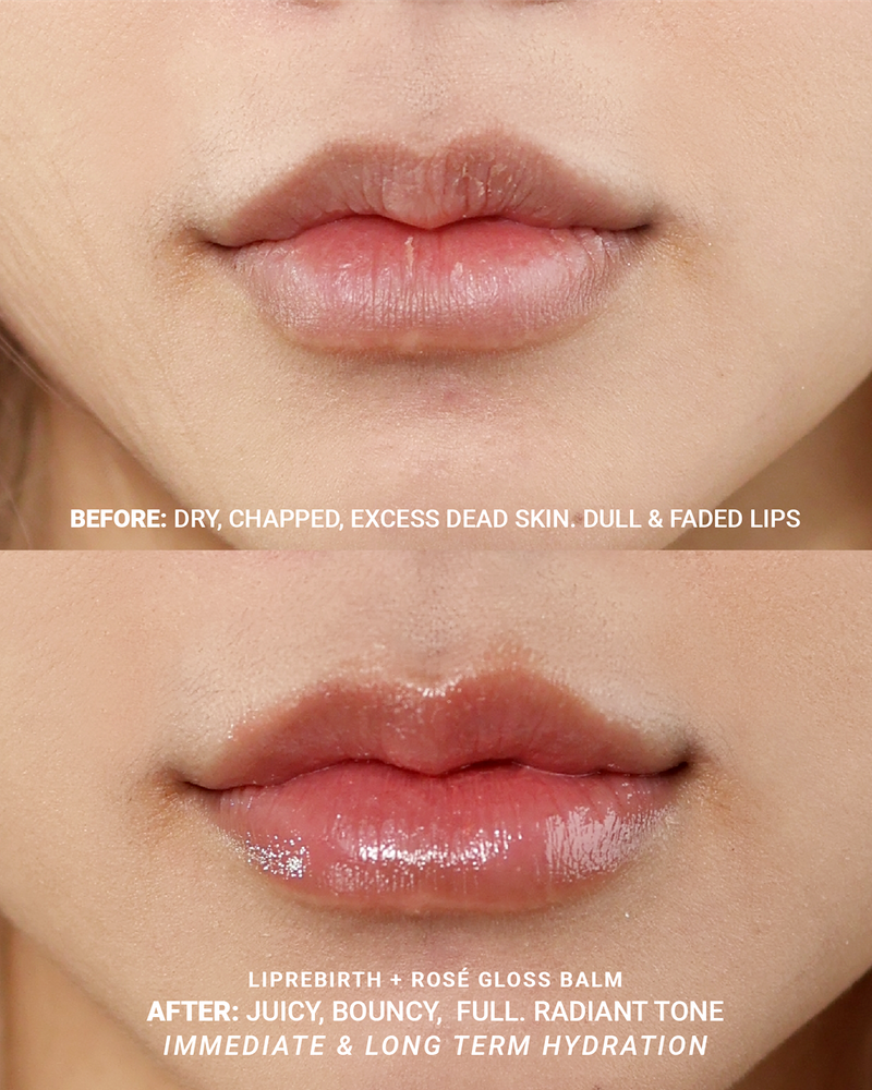 
                  
                    Lip Cure Bundle
                  
                 