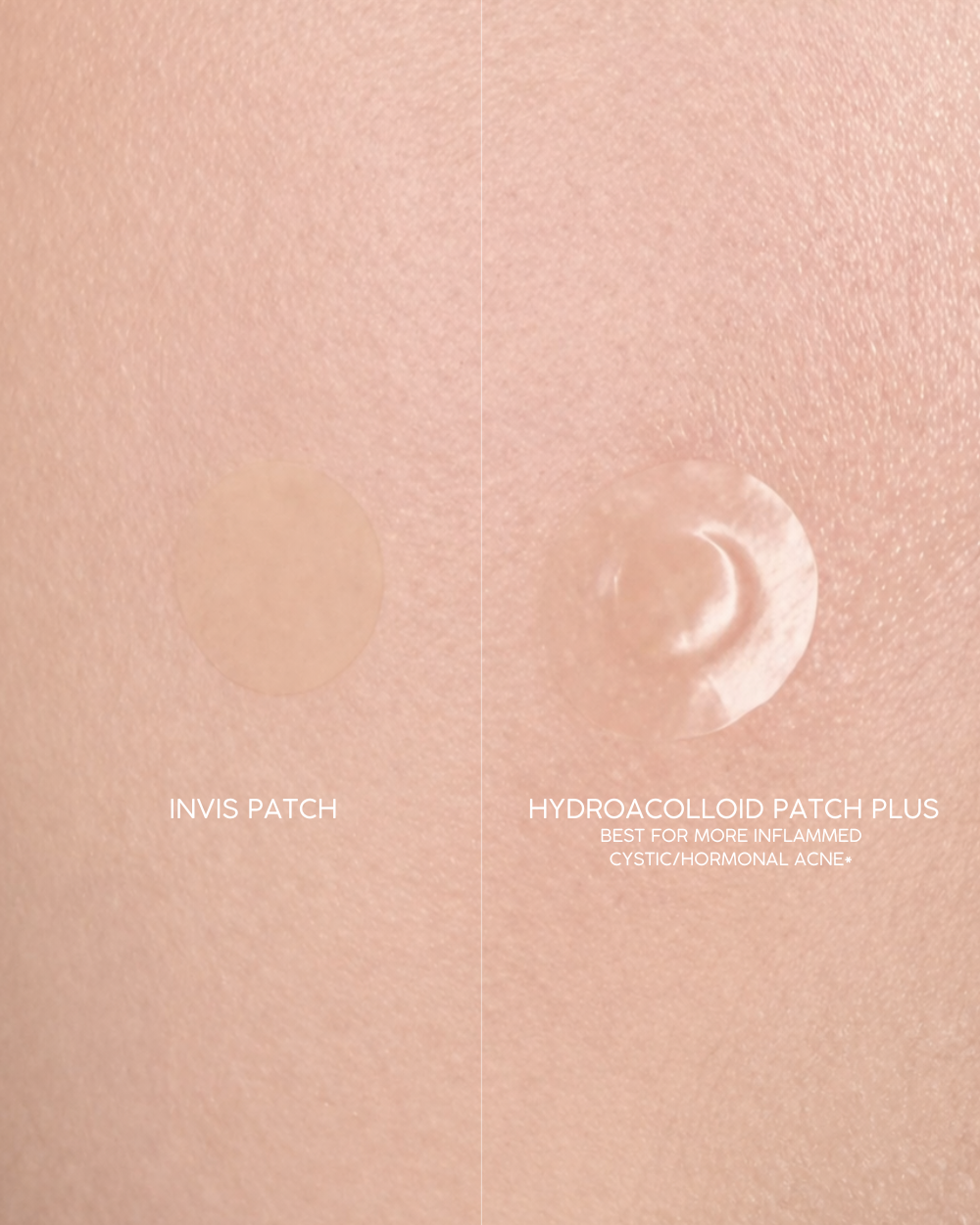
                  
                    Acne Patch Assorted Kit
                  
                